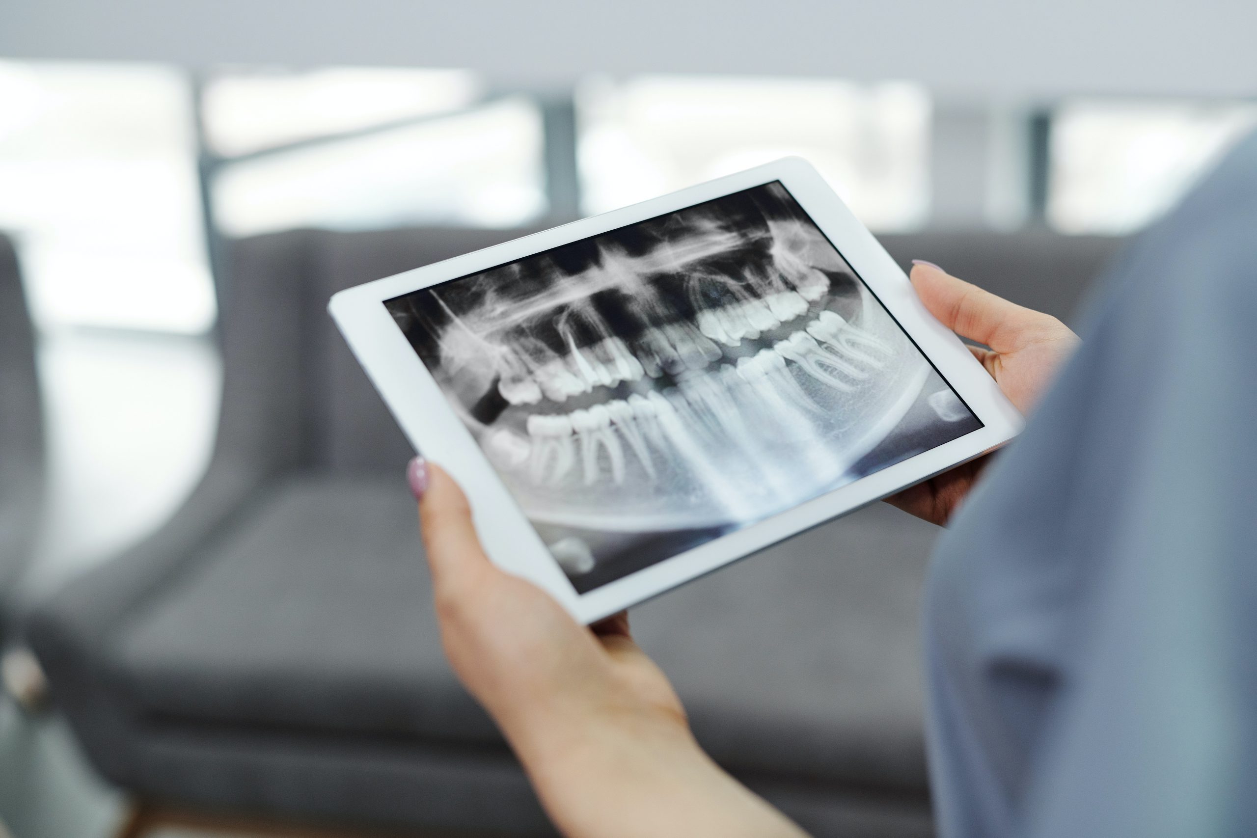 An image of a person holding a sample digital radiograph.